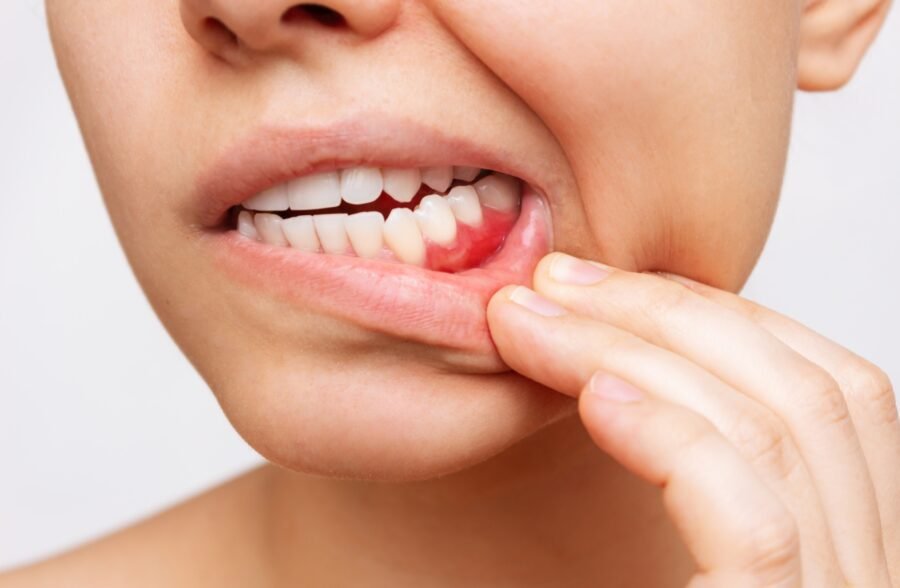 Gum Disease Treatment Services in Lahore