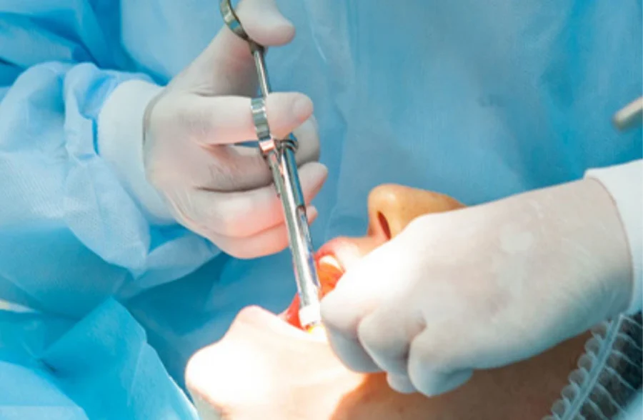 Oral & Maxillofacial Surgeon in Lahore