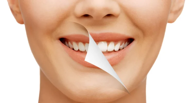 Smile Makeover From Best Cosmetic Dentist in Lahore