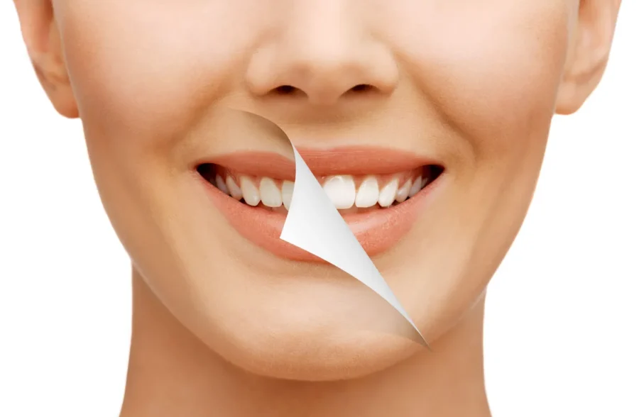 Smile Makeover From Best Cosmetic Dentist in Lahore